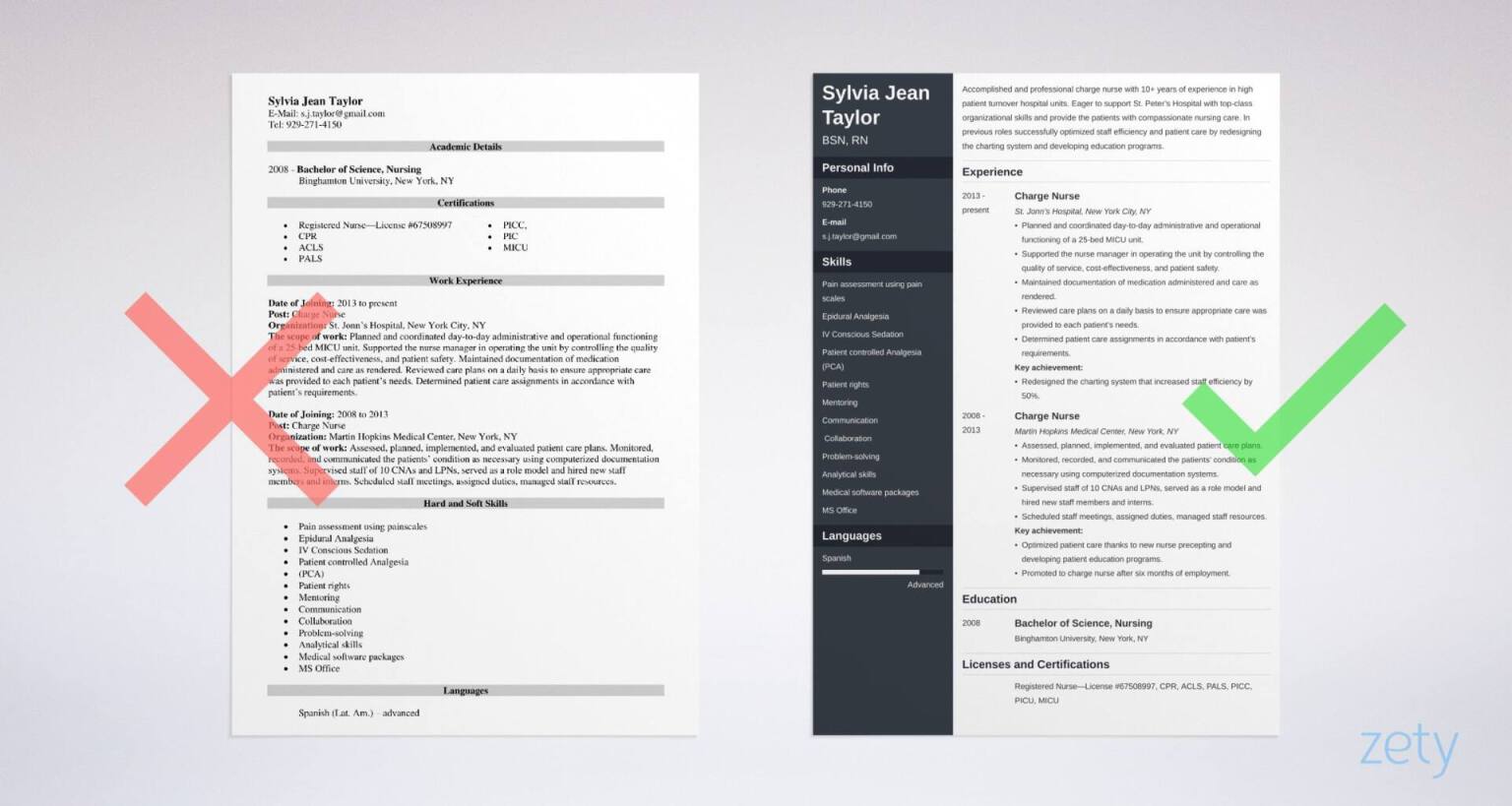 Charge Nurse Tips] Resume Examples Writing \u0026 Guide [20+