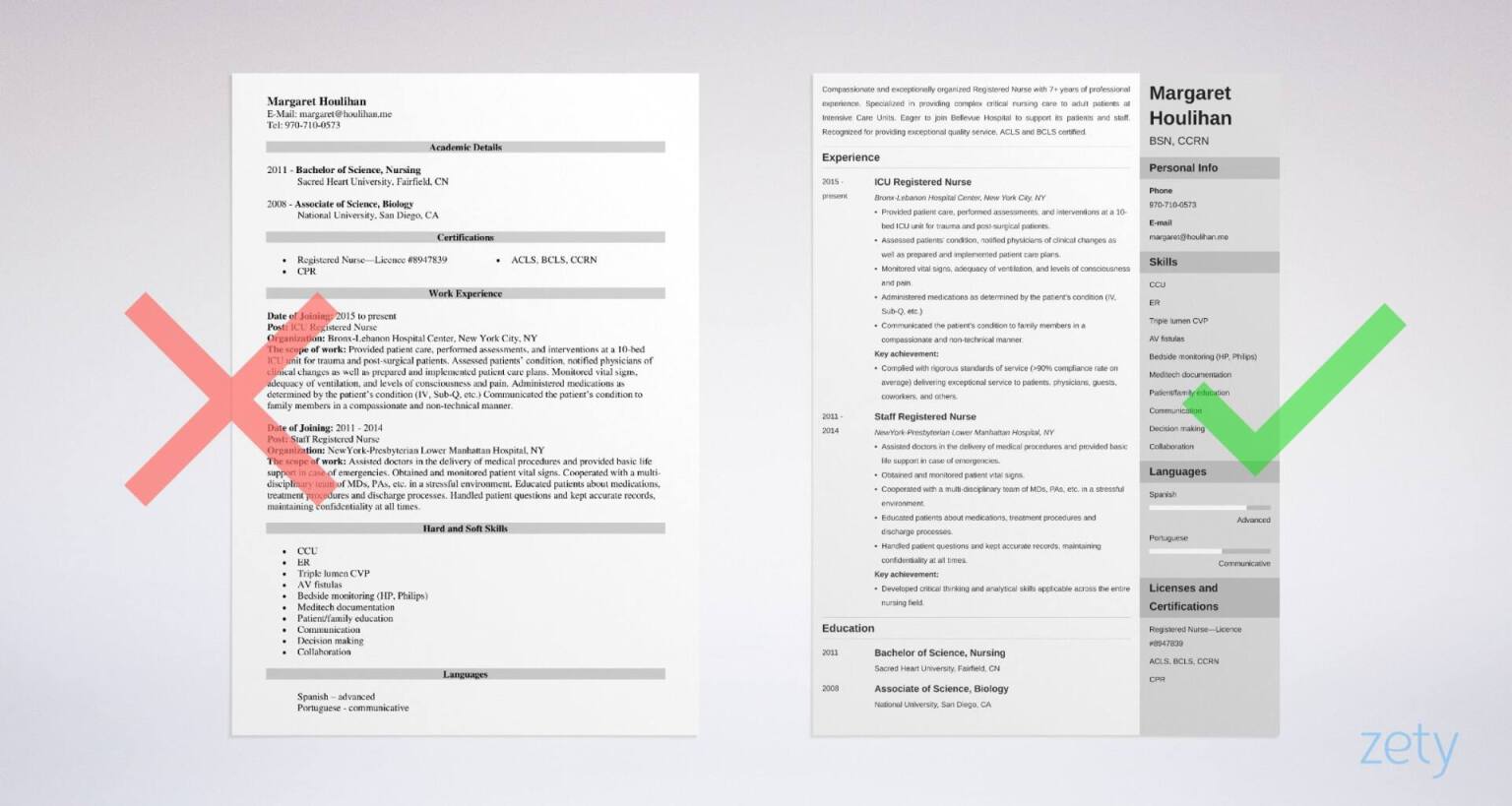 icu-rn-resume-template-karoosha