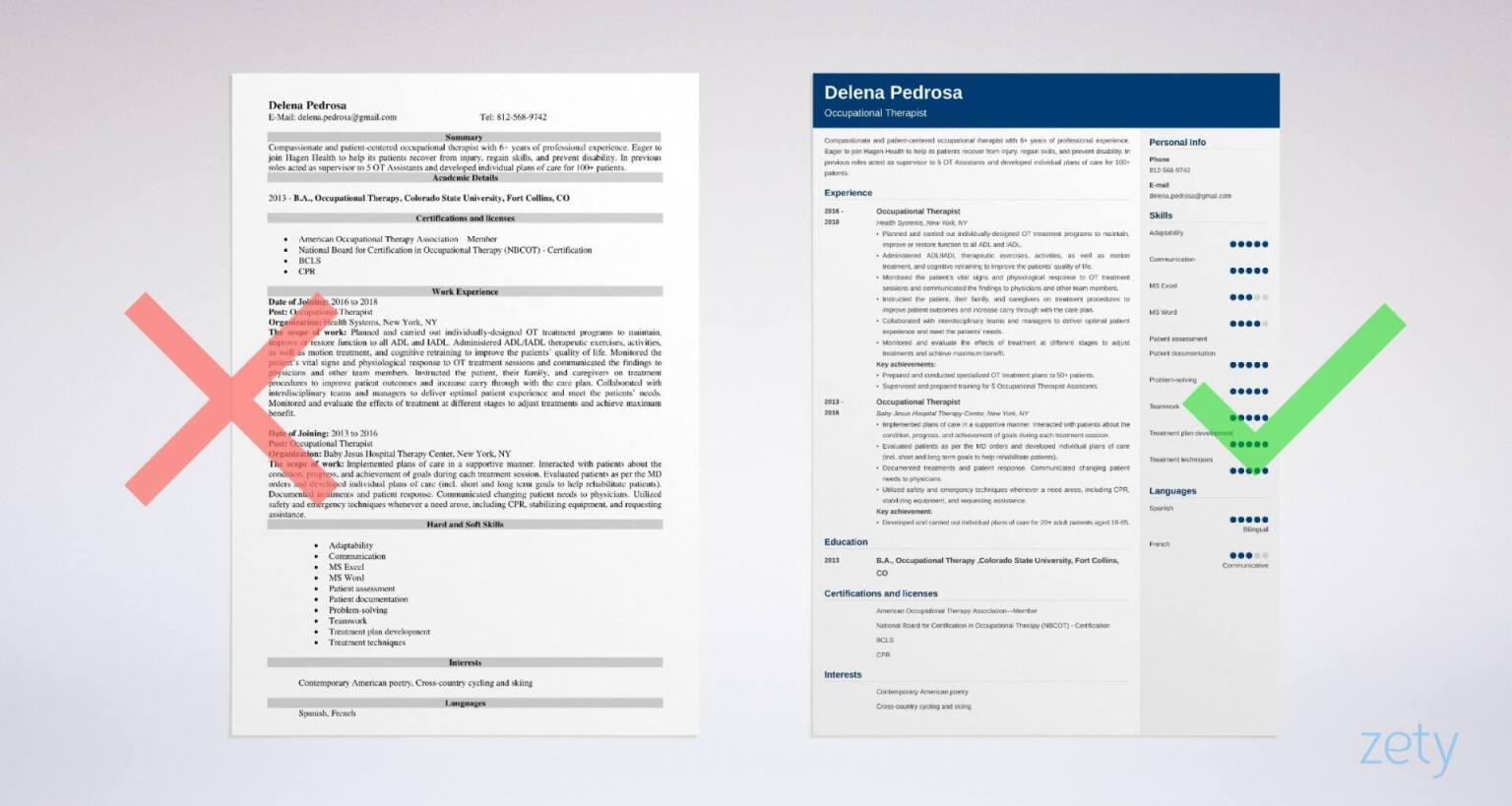 occupational therapy resume templates